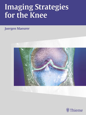 cover image of Imaging Strategies for the Knee